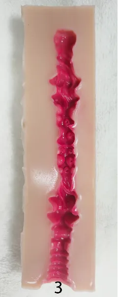 #3(17.5cm)